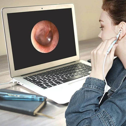 3 In 1 USB Ear Scope With Camera For Android And PC showing woman inspecting ear canal with laptop displaying close-up ear image