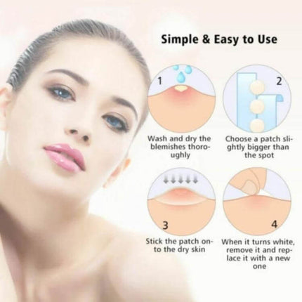 Acne Patch Kit For Pimples, Invisible Hydrocolloid Patches, 24 Count - step-by-step usage diagram for discreet pimple care