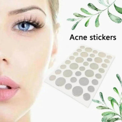Acne Patch Kit For Pimples, Invisible Hydrocolloid Patches, 24 Count – clear dot patches on sheet next to woman’s flawless cheek for discreet daytime and under-makeup use