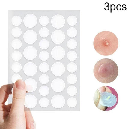 Acne Patch Kit For Pimples, Invisible Hydrocolloid Patches, 24 Count clear round patches sheet held by hand showing three sizes and plugged acne healing demo