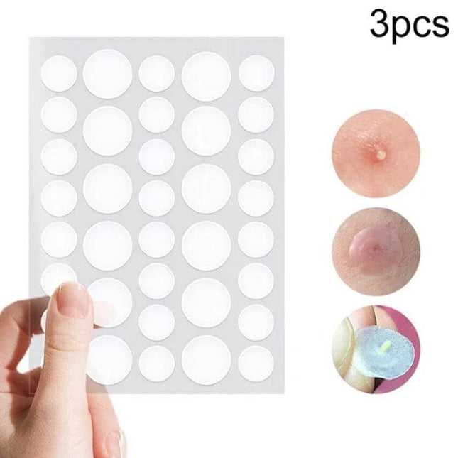 Acne Patch Kit For Pimples, Invisible Hydrocolloid Patches, 24 Count clear round patches sheet held by hand showing three sizes and plugged acne healing demo