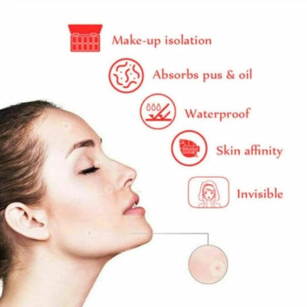 Acne Patch Kit For Pimples, Invisible Hydrocolloid Patches, 24 Count on model demonstrating waterproof, invisible acne patches and benefits