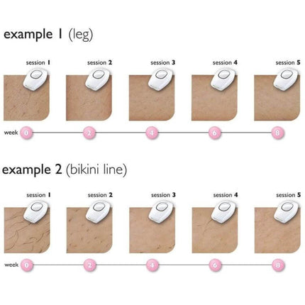 Aimanfun IPL Epilator For Whole Body Hair Removal At Home showing progress diagrams for leg and bikini line over five sessions