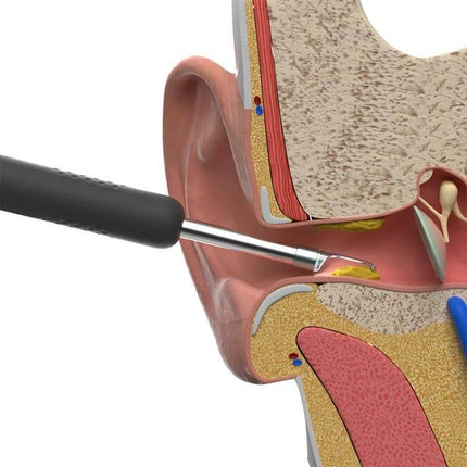 Bebird Endoscope Ear Cleaning Tool Black for Home Use showing device tip in ear canal capturing close-up 3MP HD image