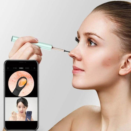 Bebird Smart Visible Luminous Ear Pick Set Star Black being used for live ear inspection with smartphone display showing ear canal view