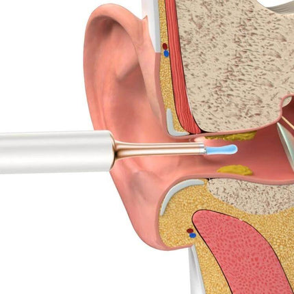 Bebird Smart Visible Luminous Ear Pick Set Star Black - close-up of probe camera inspecting ear canal with earwax visible