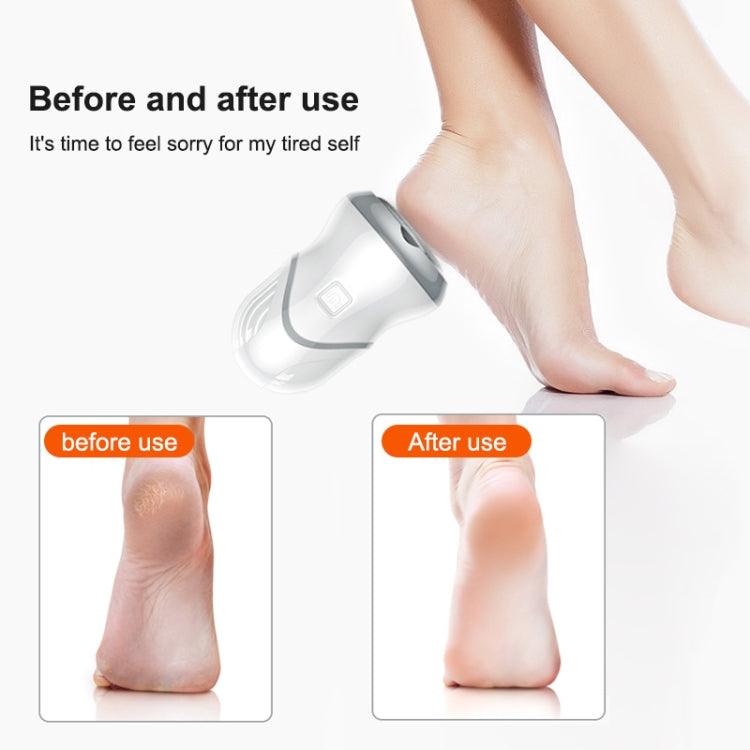 Multifunctional Electric Foot Grinder for Callus Removal and Pedicure Care