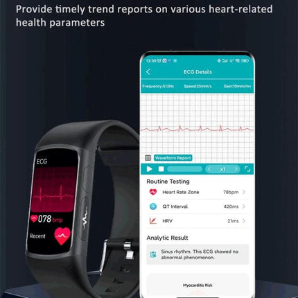 SPOVAN Bracelet for Daily Health and Activity Tracking showing ECG waveform, heart rate 78 bpm, and mobile app analytics