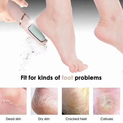 Electric Foot Grinder Rechargeable For Daily Home Use handheld two-speed callus remover showing smoothing of dry skin and cracked heel