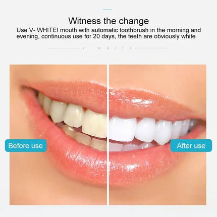 Vwhite Silicone Electric Toothbrush With 3 Cleaning Modes