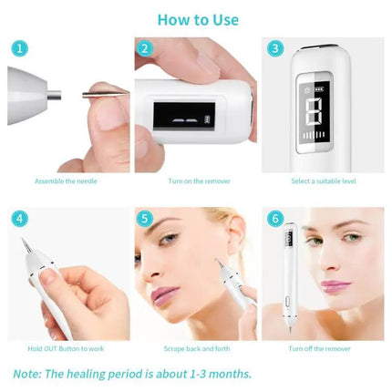 Xpreen Dark Spot Remover For Freckles Everyday Use | Syndmart
