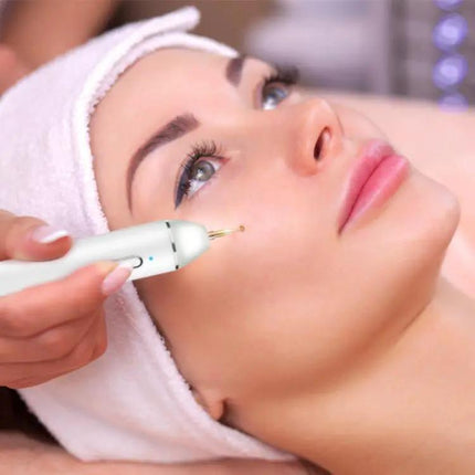 Xpreen Dark Spot Remover For Freckles Everyday Use | Syndmart