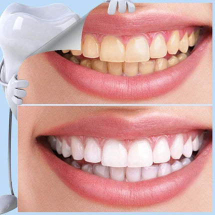 Nano Teeth Whitening Set Enamel Safe For Daily Care before and after smile showing quick enamel-safe daily whitening touch-ups