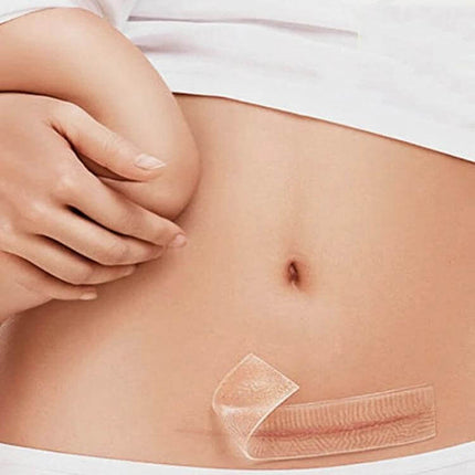 Organic Silicone Gel Scar Patch 3.5 x 12 cm For Scar Care applied to cesarean scar on clean dry skin for scar management
