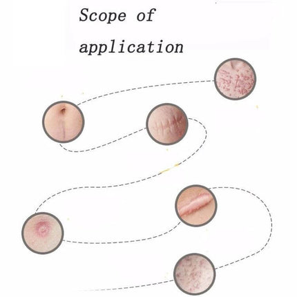 Organic Silicone Gel Scar Patch 3.5 x 12 cm For Scar Care - silicone scar sheet shown applied to various scars (surgical, burn, acne, c-section)
