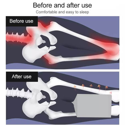 Orthopedic Memory Foam Knee Wedge Pillow For Sleeping showing before and after spine and hip alignment relief