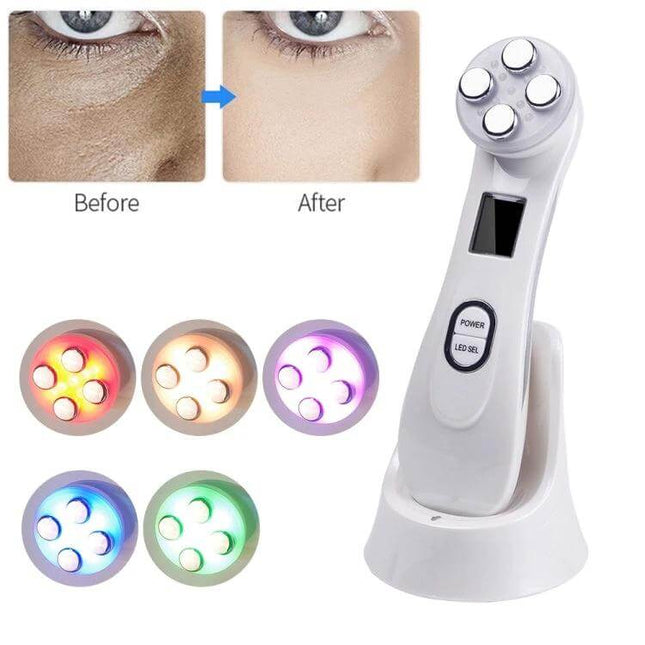 Radio Frequency Facial Beauty Pen For Wrinkle Reduction compact at-home device with LED modes shown alongside before and after eye area results