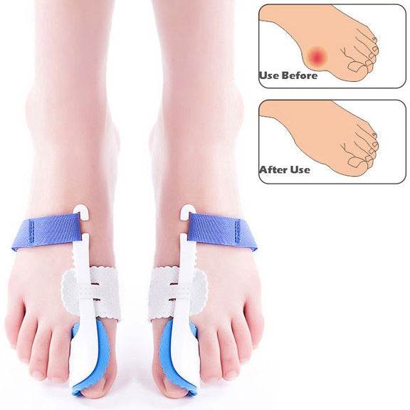 1 Pair ZRWC14 Bunio Night Splint Straightener for Big Toe