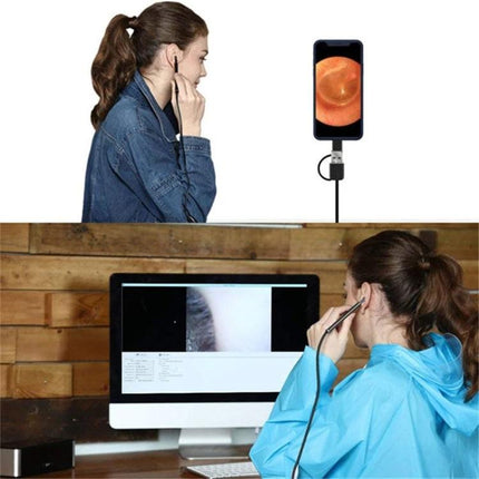 USB Digital Otoscope for Ear Inspection and Wax Viewing showing a user inspecting ear with camera and live images on phone and monitor