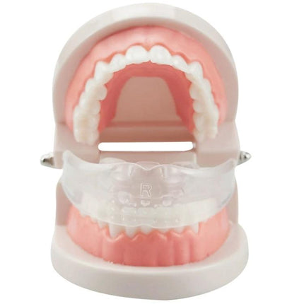 Orthodontic Silicone Simulation Braces For Nighttime Use clear TPE nighttime mouth guard on dental model for gentle sleep alignment