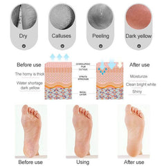 Silicone Beach Socks with Heel Guard and Moisturizing Benefits