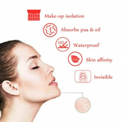 Acne Patch Kit For Pimples, Invisible Hydrocolloid Patches, 24 Count | Syndmart