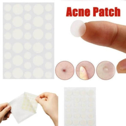 Acne Patch Kit For Pimples, Invisible Hydrocolloid Patches, 24 Count showing three sizes of clear round patches on finger and sheet for discreet pimple care