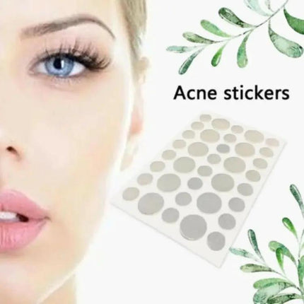 Acne Patch Kit For Pimples, Invisible Hydrocolloid Patches, 24 Count | Syndmart