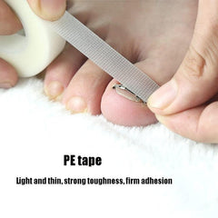 Ingrown Toenail Correction System with Orthopedic Buckle and PE Tape