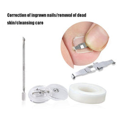 Ingrown Toenail Correction System with Orthopedic Buckle and PE Tape