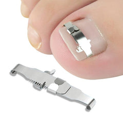 Ingrown Toenail Correction System with Orthopedic Buckle and PE Tape