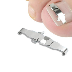 Ingrown Toenail Correction System with Orthopedic Buckle and PE Tape