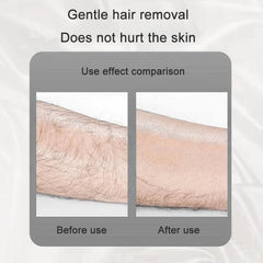 Gentle Crystal Epilator - Painless Hair Removal and Exfoliation Device for All Skin Types