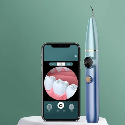 Visual Ultrasonic Scaler For Tartar Removal Blue Gradient