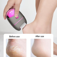 Women’s Electric Foot File and Callus Remover Machine with LED Light and LCD Display