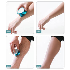 Dual Action Foot Care Tool: 2-in-1 Dead Skin Remover and Pedicure Epilator