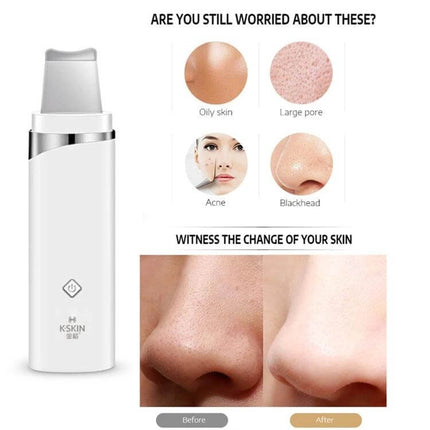 Ultrasonic Blackhead Remover Pore Cleaner For Facial Care - compact device showing before and after nose pore improvement