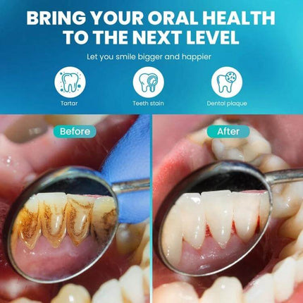 Ultrasonic Calculus Removal Dental Scaler For Home Use showing before-and-after tartar and plaque removal with LED display and stainless steel tip