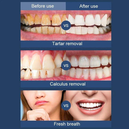 Ultrasonic Electric Scaler Portable For Home Dental Cleaning showing before and after tartar, calculus removal and fresh breath results