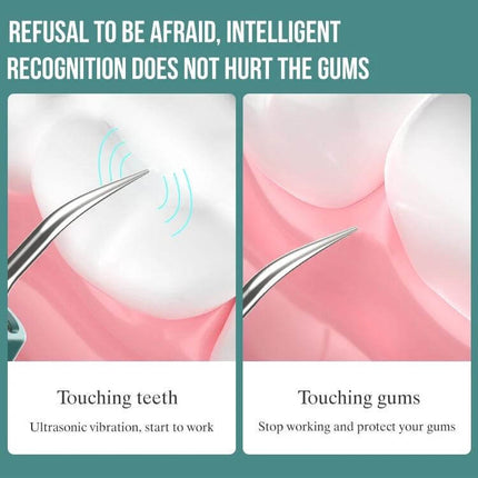 Visual Ultrasonic Scaler For Tartar Removal Blue Gradient showing curved stainless steel head visualizing tartar on tooth and protecting gums