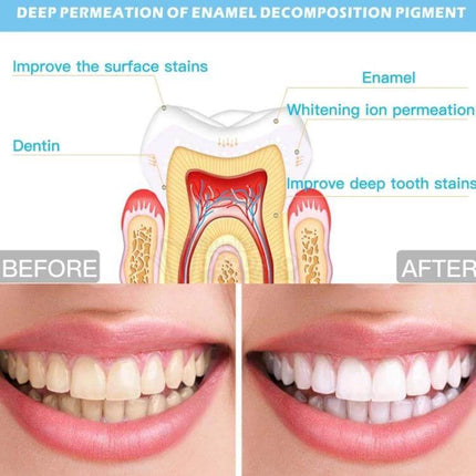 Wire-Controlled Teeth Whitening Device For Home Use showing tooth cross-section and before-and-after whitening results