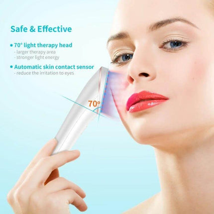 XPREEN Acne Light Therapy Device, Wireless for Home Use handheld LED device emitting red and blue light to treat cheek acne at 70° angle