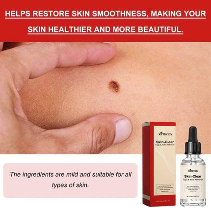 Ximonth 20ml Mole And Wart Remover Liquid For Skin bottle and packaging next to treated facial mole showing smoother skin