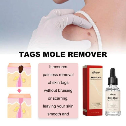 Ximonth 20ml Mole And Wart Remover Liquid For Skin shown with applicator, packaging and before-after mole removal illustration