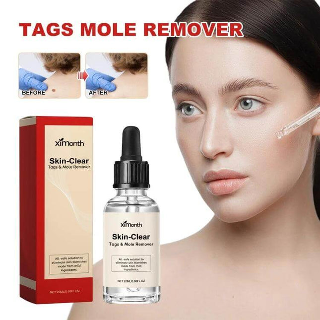 Ximonth 20ml Mole And Wart Remover Liquid For Skin - bottle and box with model applying dropper for facial mole wart removal