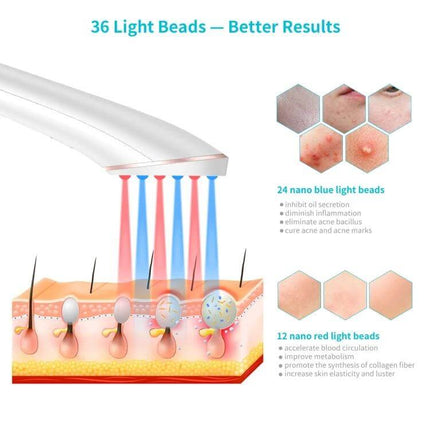 XPREEN Acne Light Therapy Device, Wireless for Home Use showing 36 LED beads (24 blue, 12 red) treating acne on cheeks and forehead