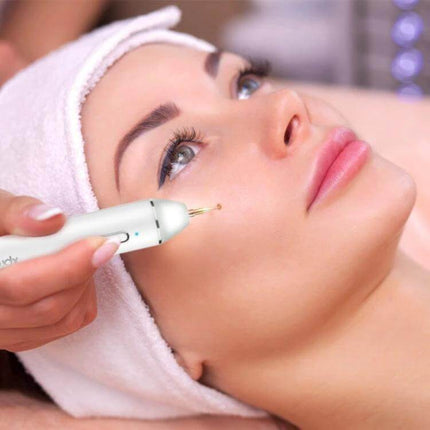 Xpreen Dark Spot Remover For Freckles Everyday Use device treating a small facial freckle at home with precision