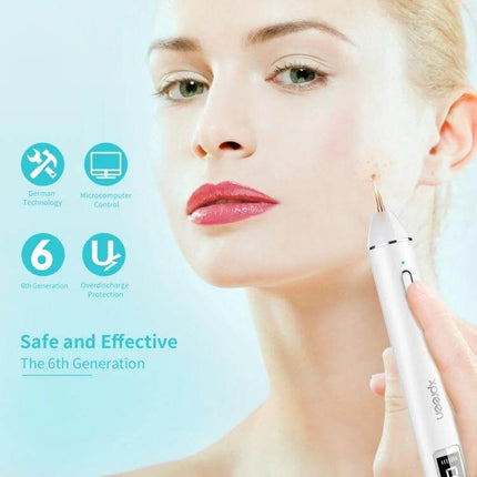 Xpreen Dark Spot Remover For Freckles Everyday Use device held near cheek demonstrating precise at-home treatment for freckles and dark spots