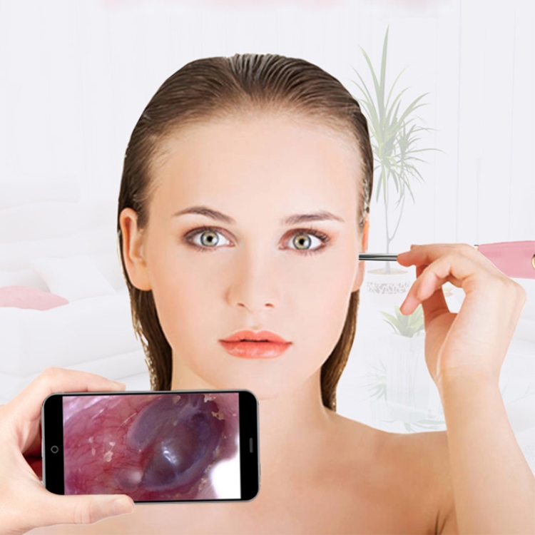 Smart Wireless Ear Cleaning Camera: 720P, 3.9mm Diameter, Safe Pick Tool 8 Smart Wireless Ear Cleaning Camera: 720P, 3.9Mm Diameter, Safe Pick Tool - Image 8