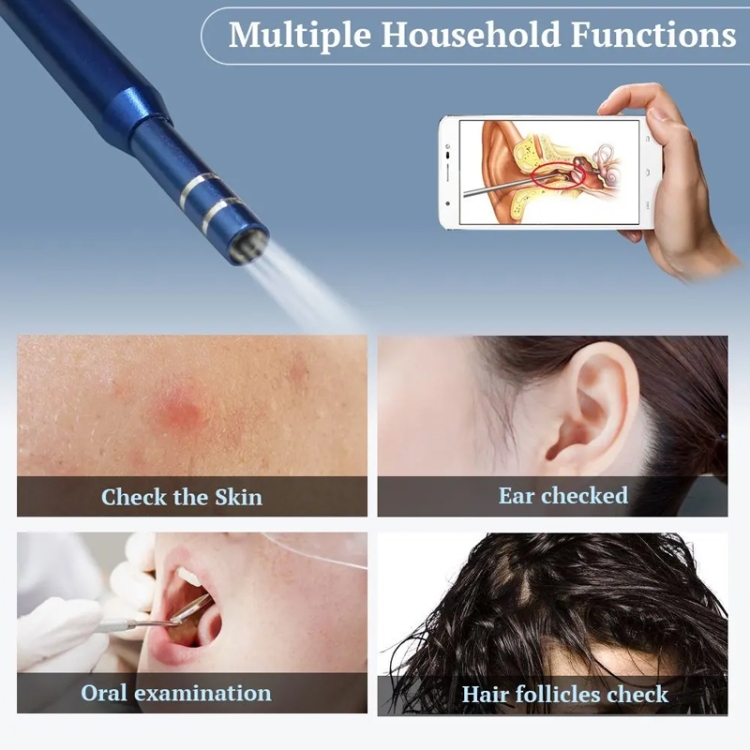 HD Ear Scope Camera - Android/PC/MacBook - 1.75m Cable - Versatile Inspection 11 Hd Ear Scope Camera - Android/Pc/Macbook - 1.75M Cable - Versatile Inspection - Image 11